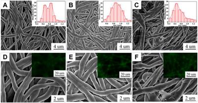 Fabrication of Curcumin@Ag Loaded Core/Shell Nanofiber Membrane and its Synergistic Antibacterial Properties